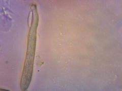 L. variegatum spóra es tömlő