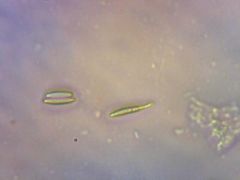 L. variegatum spórák