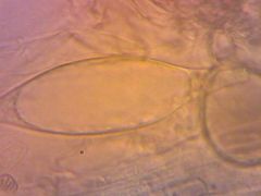 Pluteus phlebophorus pleurocisztida