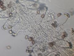 Nyír- nyárelegyes tölgyesben