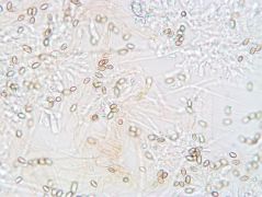 Krizocisztidium (középen)