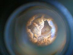 Pusztai kucsmagomba a nagyító alatt