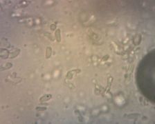 Hydropus subalpinus allantoid spóra