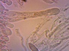 C. helveticus cisztidium