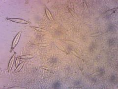 Hohenbuehelia auriscalpium pleurocisztidák