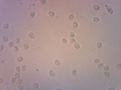 Hohenbuehelia auriscalpium spórák