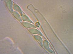 Spóra fotó (fűzön)