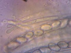 Peziza repanda parafízisek