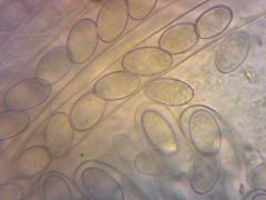 Peziza repanda spóra