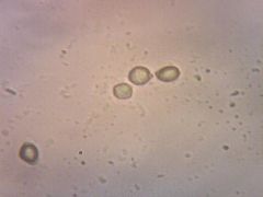 Dermoloma cuneifolium spórakép