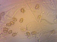 Inocybe lanuginosa spórakép