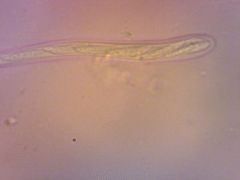 H. phyllophilus spórák a tömlőben
