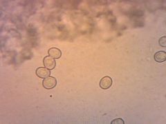 Pluteus hispidulus spórák