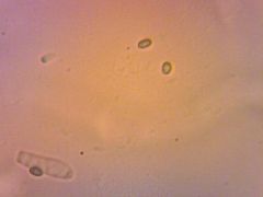Bisporella subpallida spóra