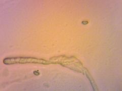 Bisporella subpallida aszkusz