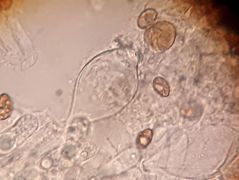 Inocybe mytiliodora spóra és cisztida