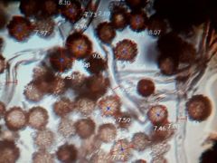 Előző évi termőtestek