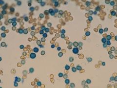 A 2015.02.22-i gyűjtés spórafotója