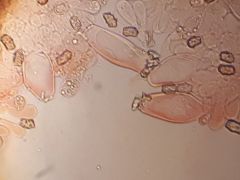 Homoki fehérnyár, rezgőnyár alatt