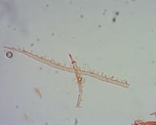 Mycena erubescens hifa tönk