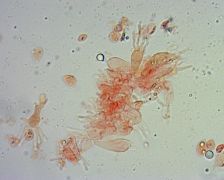 Mycena erubescens keilocisztidium