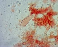 Mycena erubescens keilocisztidium