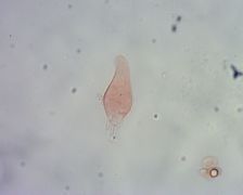Mycena erubescens keilocisztidium