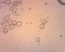 Entoloma incarnatofuscescens spórakép