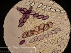 Ascobolus foliicola H20 40x