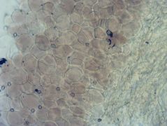 Pluteus luctuosus - a kalapbőr kereksejtes