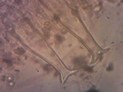 Pluteus petasatus koronás cisztidák