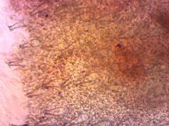 Pluteus petasatus koronás cisztidák