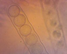 Scutellinia trechispora tömlő spórákkal