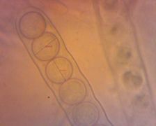 Scutellinia trechispora spóraméretek